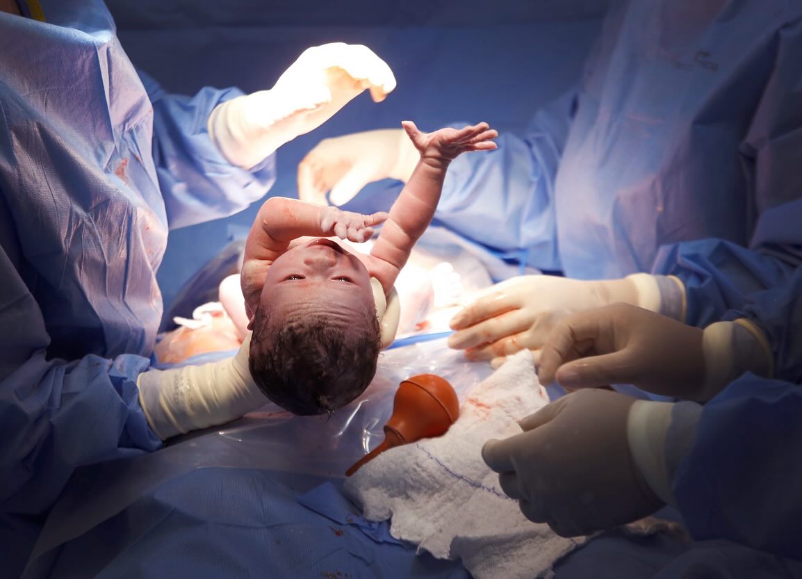 Newborn baby